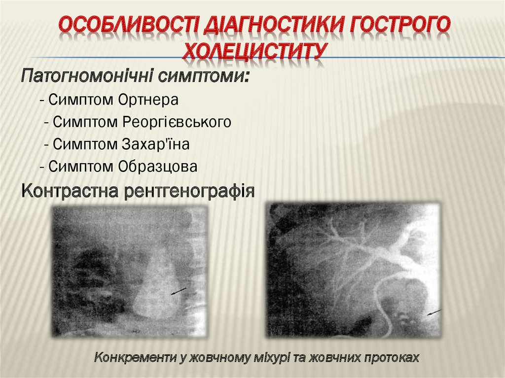 Холецистит карта смп