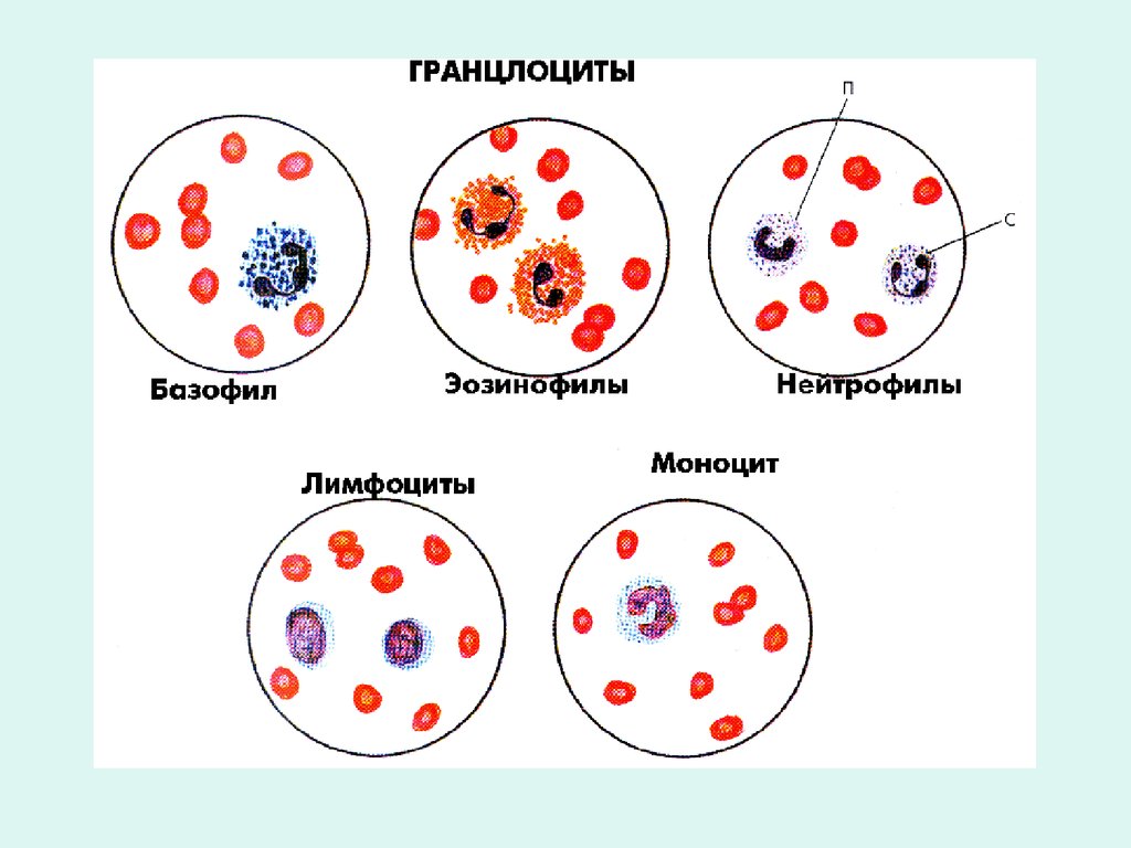 Лейкоциты нейтрофилы эозинофилы. Лейкоциты периферической крови. Форменные элементы крови в мокроте. Форменные элементы крови нейтрофилы. Гранулоциты.