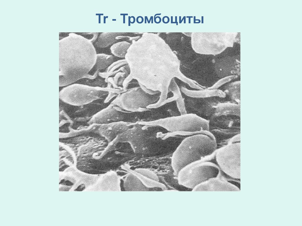 Тромбоциты рисунок. Тромбоциты под микроскопом. Рисунок тромбоцита человека. Тромбоциты презентация.