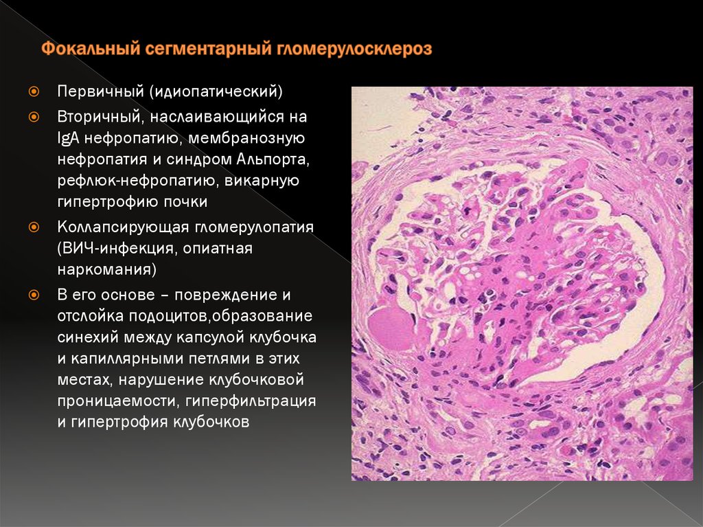 Вич патанатомия презентация