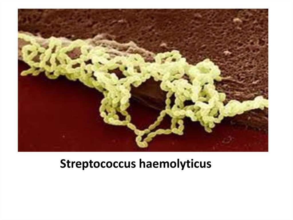 Streptococcus haemolyticus