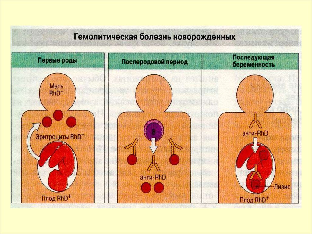 Резус фактор болезни