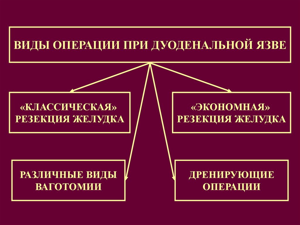 Виды хирургии. Дренирующие операции при язве. Дренирующие операции при язве желудка. Виды дренирующих операций при язвенной.