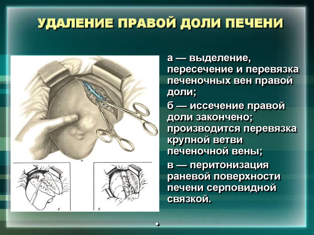 Удаление потерянного сегмента записи о файле что это