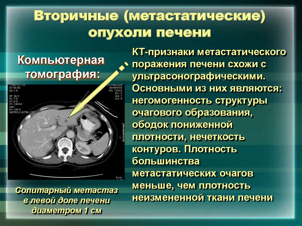 Вторичные признаки поражения