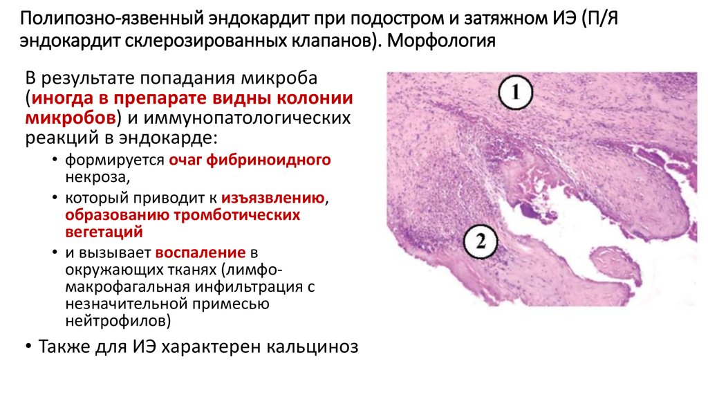 Патологическая анатомия сепсиса презентация