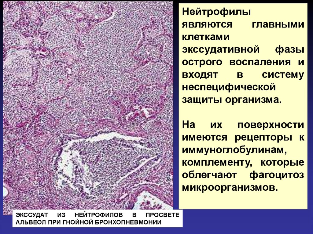 В очаге острого воспаления нейтрофилы секретируют. Нейтрофил клетка острого воспаления это. Экссудативное воспаление клетки. Рецепторы нейтрофилов. Клетки участвующие в воспалении экссудативное.