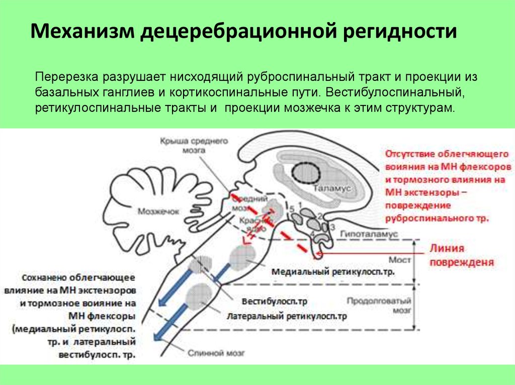 Механизм физиология. Руброспинальный тракт физиология. Ретикулоспинальный путь физиология. Схема руброспинального тракта. Рубно-спинальный тракт.