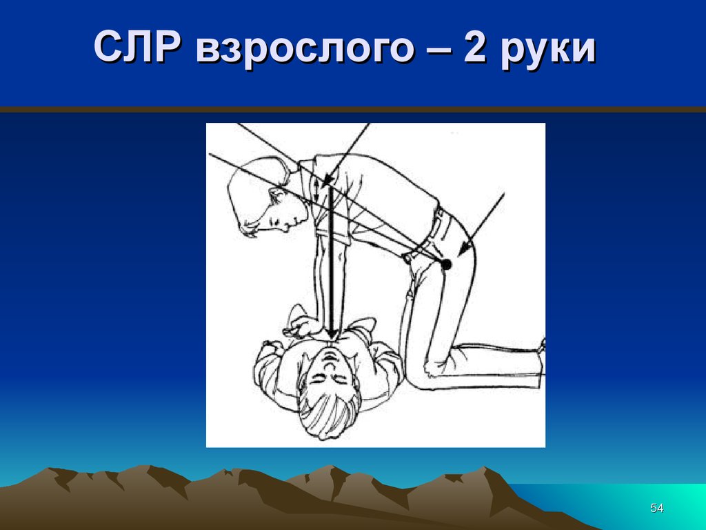 Руки при сердечно легочной реанимации