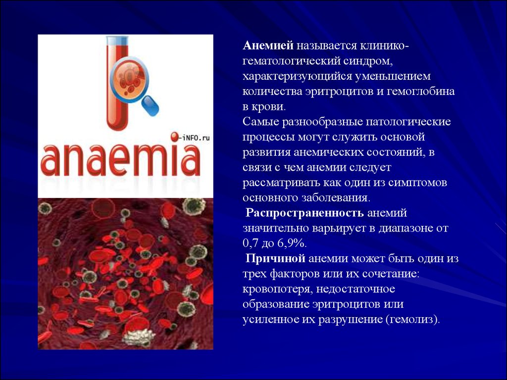 Причины анемии крови