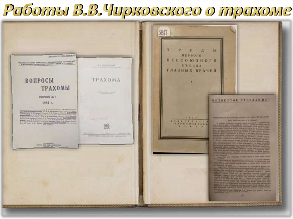 Работы В.В.Чирковского о трахоме