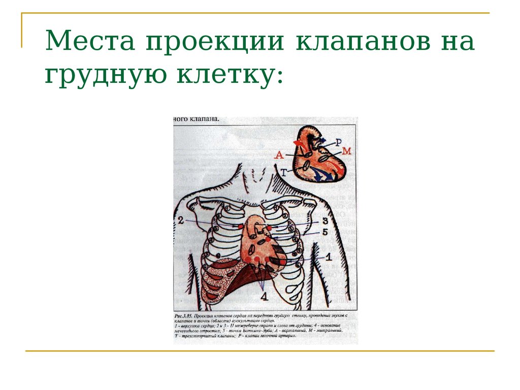 Проекция клапанов сердца на грудную стенку