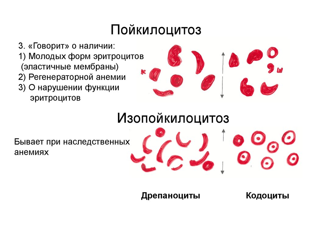 Анемия и эритроциты в крови. Пойкилоцитоз формы эритроцитов. Изменение формы эритроцитов (пойкилоцитоз). Классификация анемий пойкилоцитоз. Патологические формы эритроцитов, понятие.