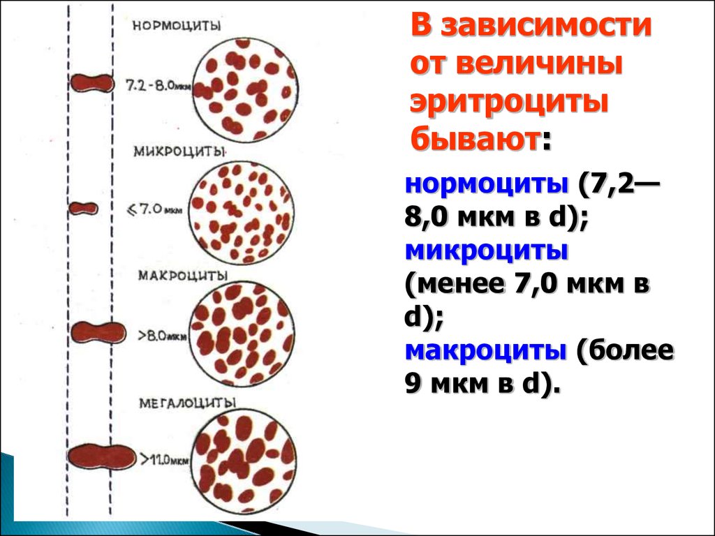 Нормоцит это. Нормоциты. Микроциты макроциты мегалоциты. Заболевания системы крови. Диаметр нормоцита.