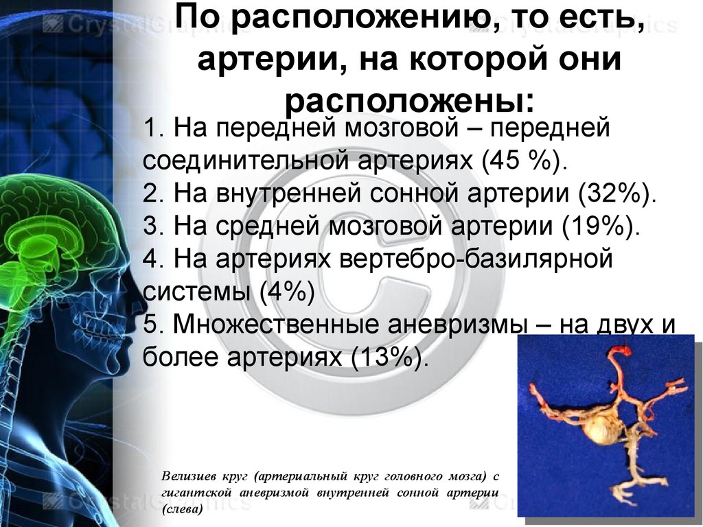 Аневризма сосудов головного мозга презентация