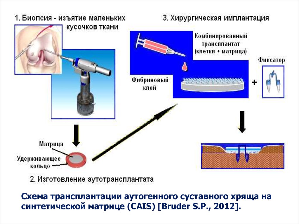 Где можно сделать биопсию. Хирургическая биопсия.