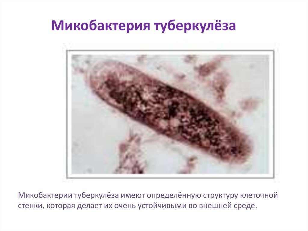 Возбудитель туберкулеза. Строение стенки микобактерии туберкулеза. Строение микобактерии туберкулеза. Микобактерии возбудители туберкулеза. Микрокапсула микобактерии туберкулеза.