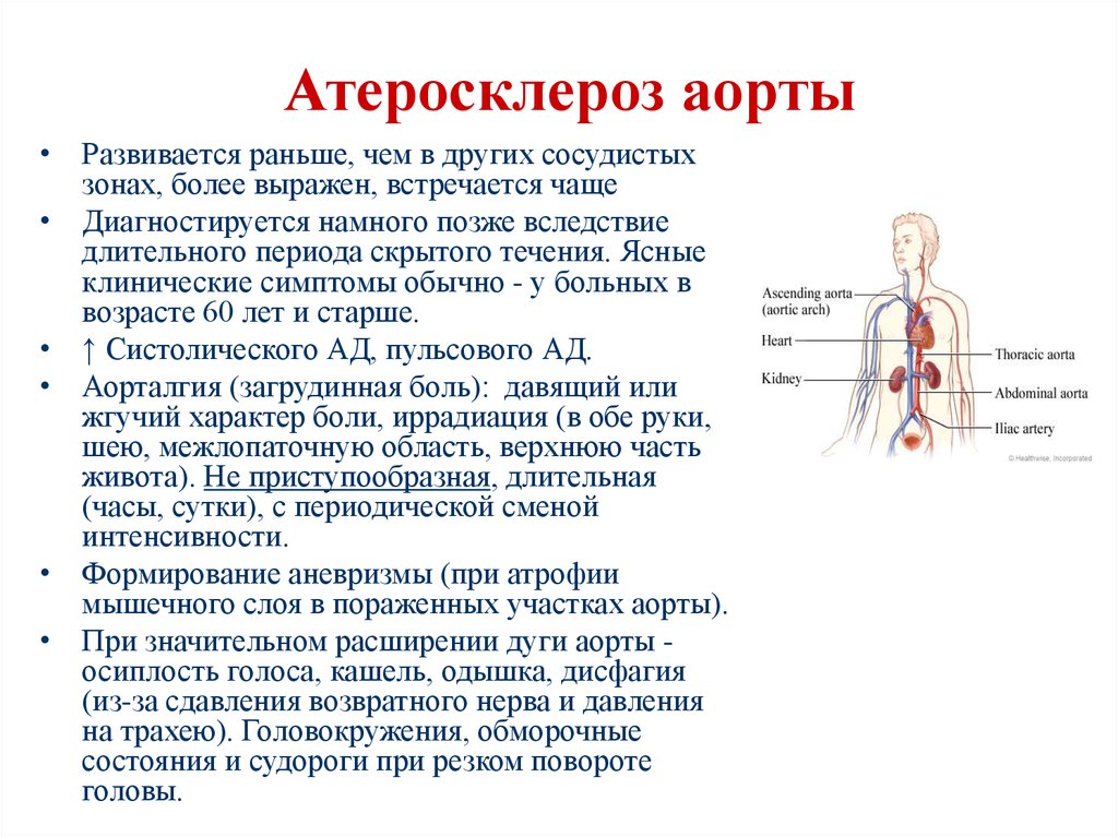Атеросклероз брюшного. Атеросклероз грудного отдела аорты. Клинические проявления атеросклероза аорты. Атеросклероз грудного отдела аорты характеризуется. Атеросклероз грудной аорты симптомы.