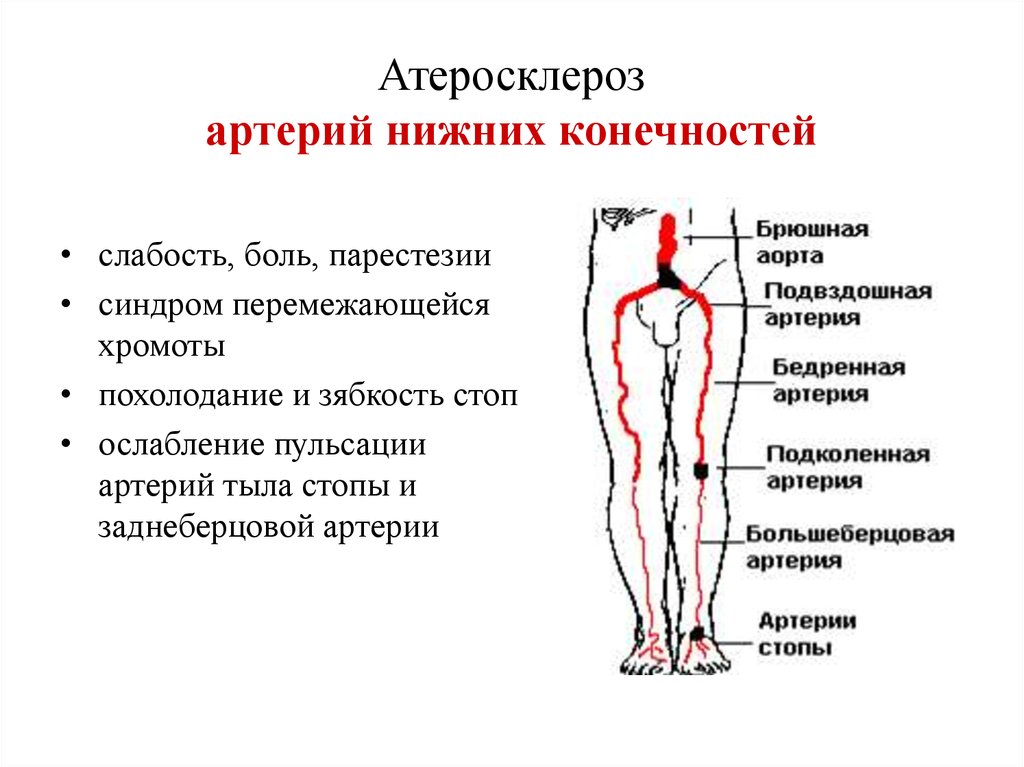 Ишемия нерва. Основные симптомы атеросклероза артерий нижних конечностей. Клинические проявления атеросклероза сосудов нижних конечностей. Атеросклероз сосудов нижних конечностей основные жалобы. Сосудов нижней конечности атеросклероза клиника симптомы.