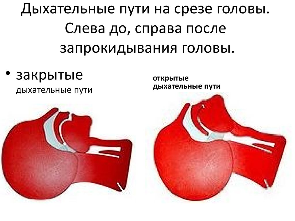 Закрытое дыхание. Открытые и закрытые дыхательные пути. Дыхательные пути справа. Запрокидывание головы дыхательные пути. Дыхательные пути справа или слева.