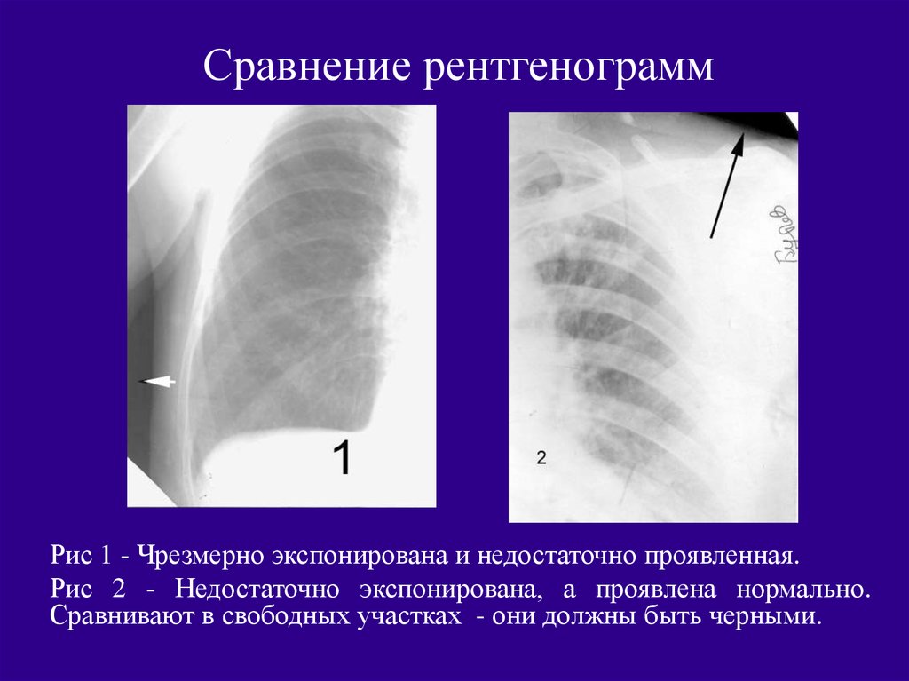 Характеристика изображений на рентгенограммах