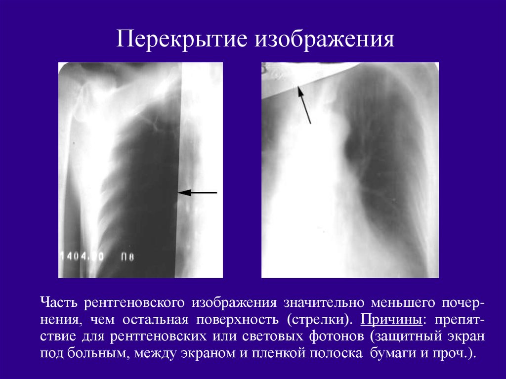 Характеристика изображений на рентгенограммах