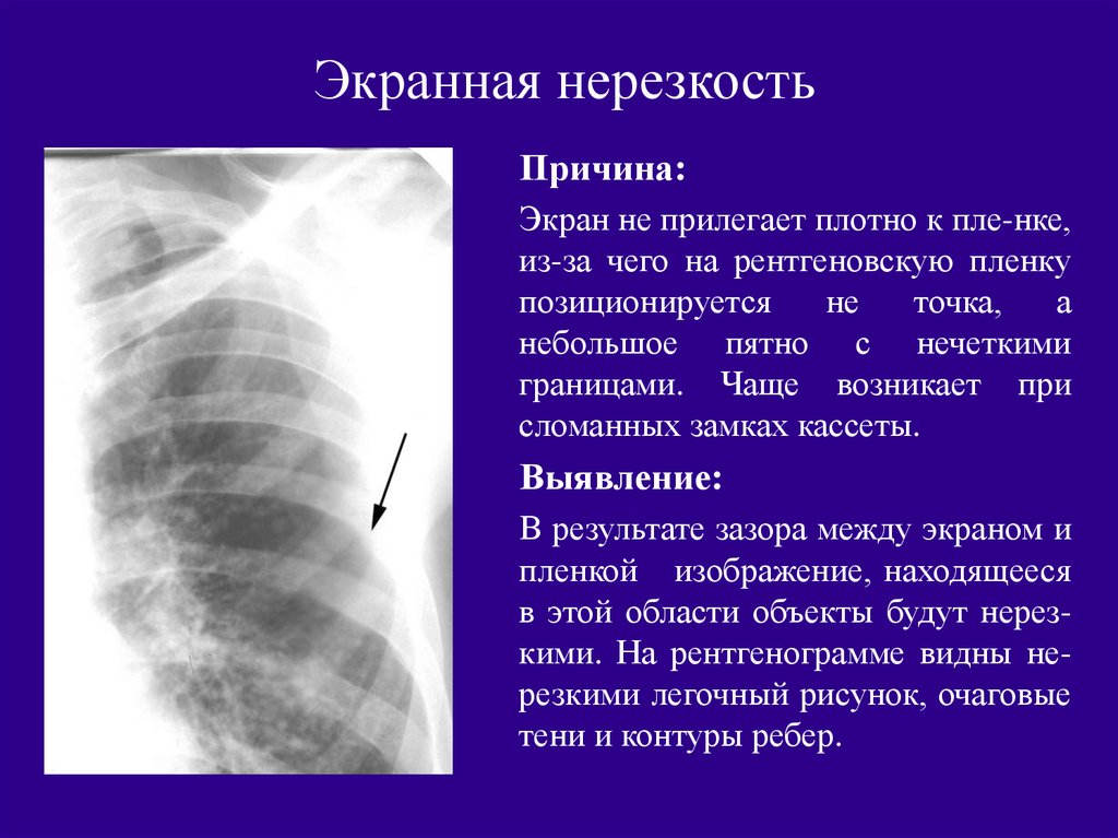 Характеристика изображений на рентгенограммах