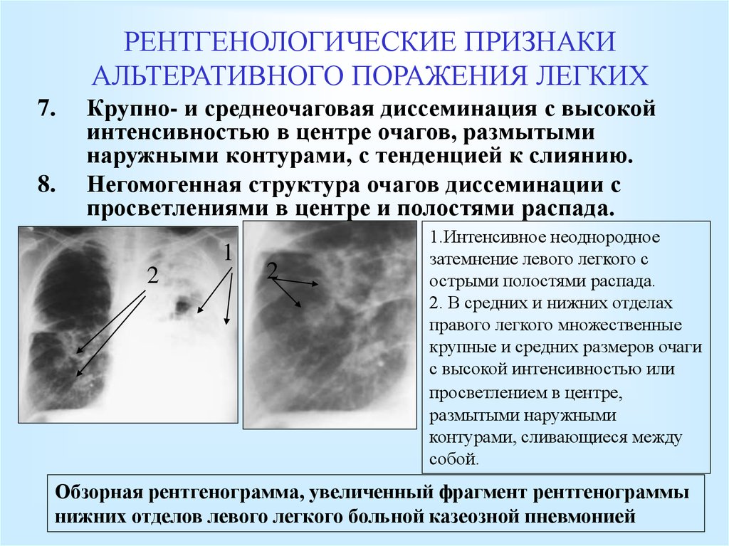 Структура очагов поражения