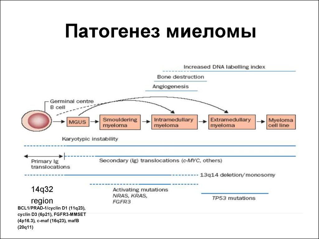 Патогенез множественной миеломы схема