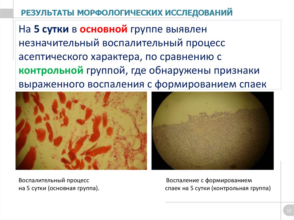 На 5 сутки в основной группе выявлен незначительный воспалительный процесс асептического характера, по сравнению с контрольной