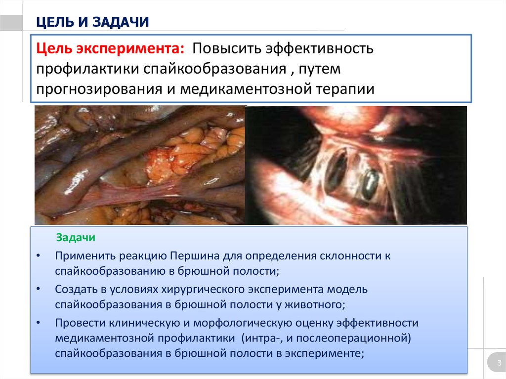 Цель эксперимента: Повысить эффективность профилактики спайкообразования , путем прогнозирования и медикаментозной терапии