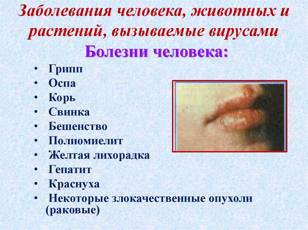 Заболевания человека, животных и растений, вызываемые вирусами