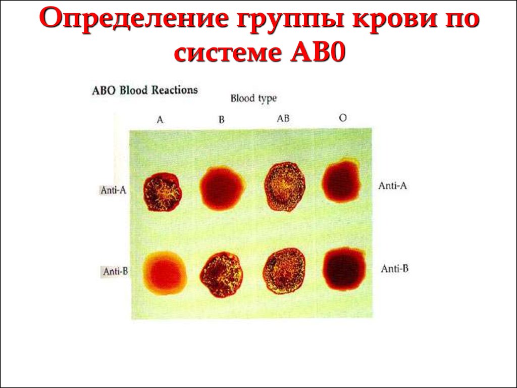 Карточка группы крови. Цвета групп крови. Группа крови по цвету. Кровь группы крови. Как определить группу крови.