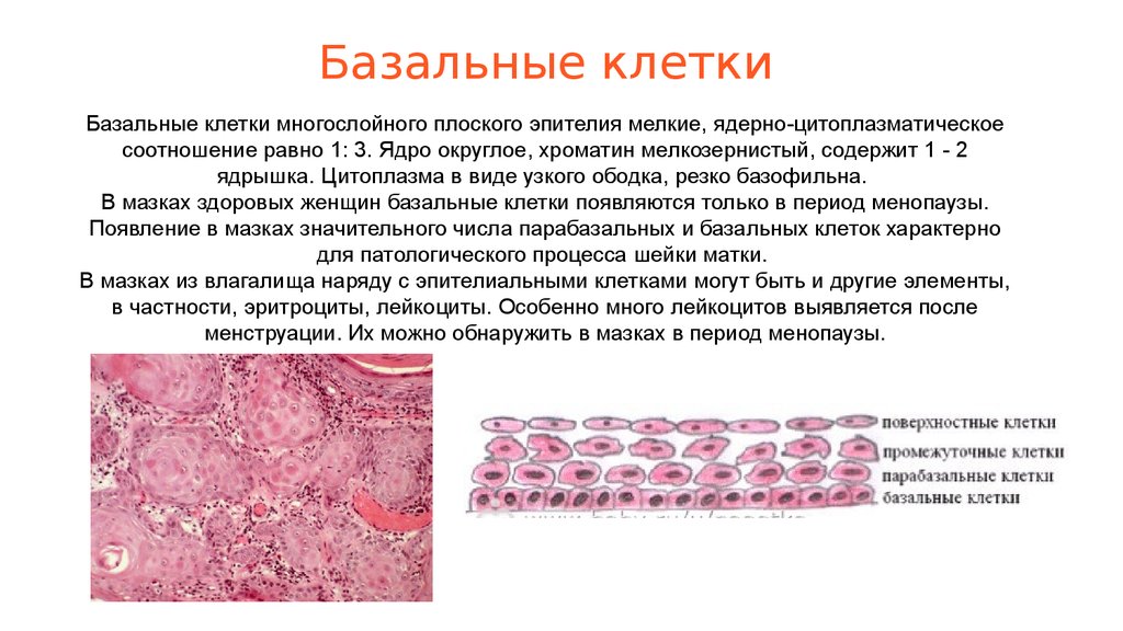 Плоский эпителий в цитограмме. Базальные клетки эпителия влагалища. Цилиндрический эпителий шейки матки гистология. Базальные эпителиоциты клетки гистология.