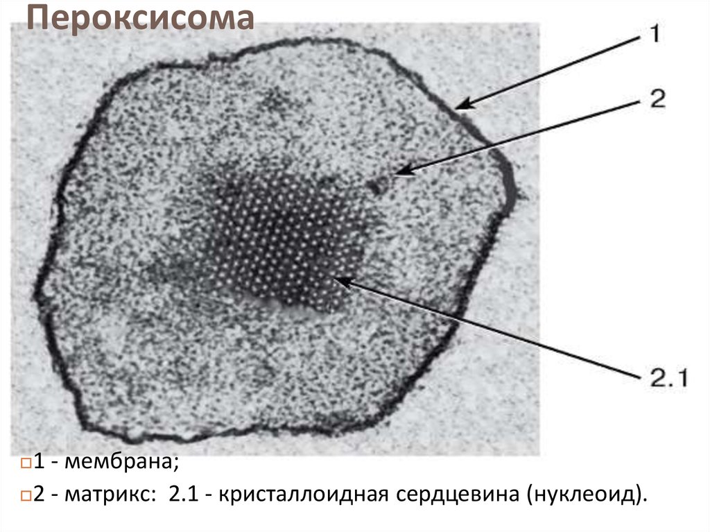 Электронная фотография листа. Пероксисомы электронная микроскопия. Пероксисомы строение микроскоп. Электронограмма пероксисомы. Пероксисома электронная микрофотография.