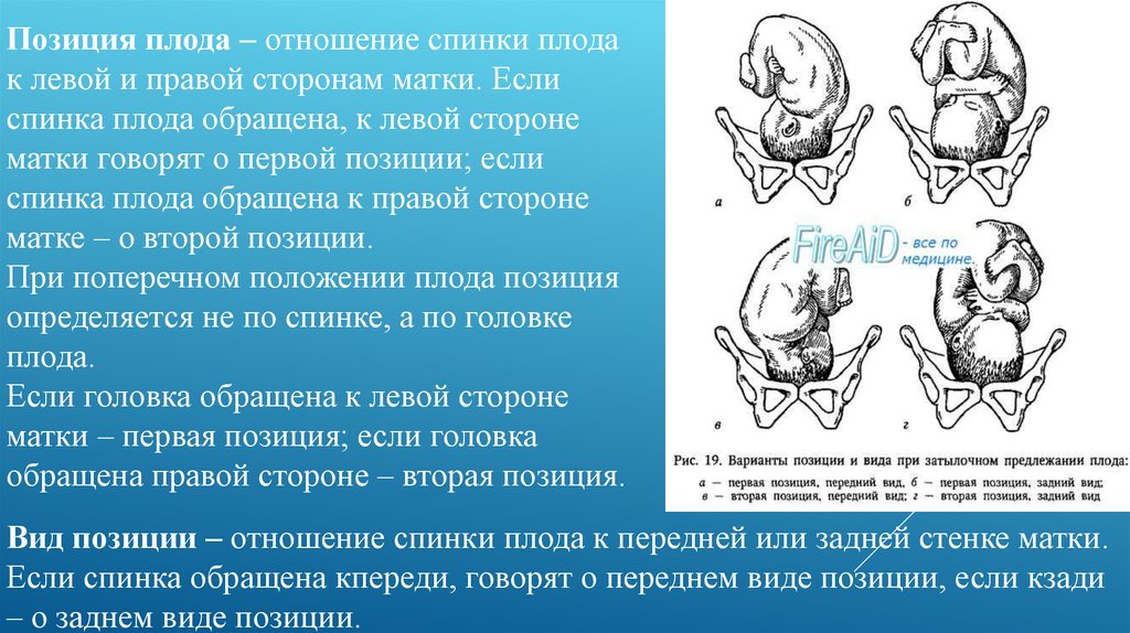 С какой стороны матка у женщины. Спинка плода спереди слева. Расположение плода с позициями. Позиция плода это отношение спинки. Вторая позиция передний вид плода.