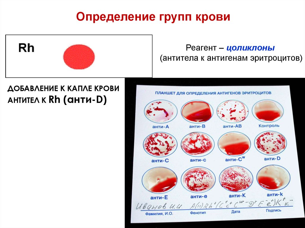 Какого размера кровь. Определение группы крови и резус фактора цоликлонами таблица. Группа крови по целиклону. Группа крови Цоликлоны. Определение группы крови крови цоликлонами.