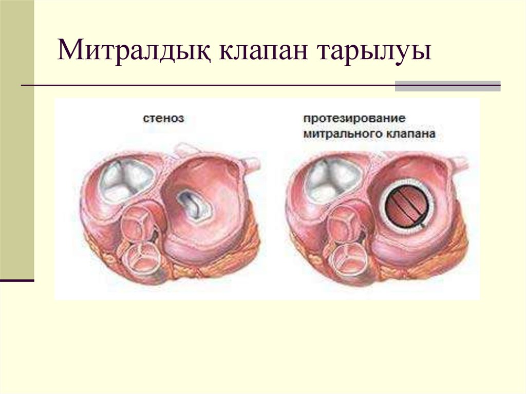 Презентация клапаны сердца