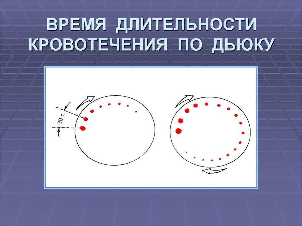 Время кровотечения. Длительность кровотечения по Дьюку норма. Длительность кровотечения по Дуке норма. Длительность кровотечения по Дьюку норма у детей. Длительность кровотечения по Дюке.