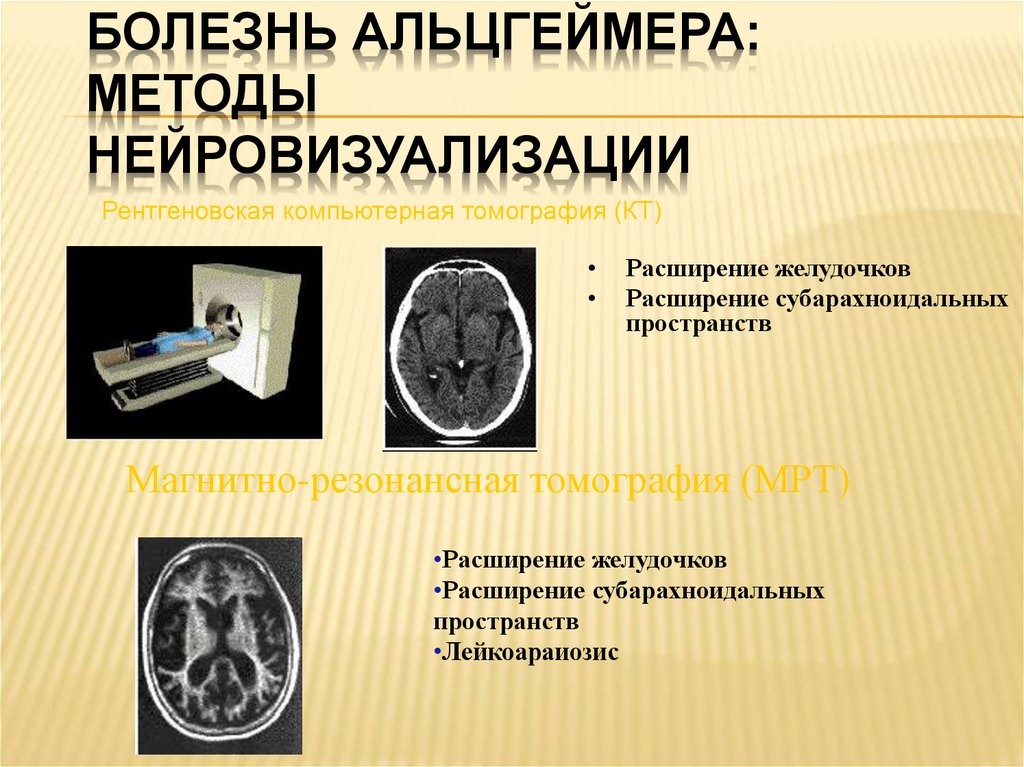 Расширение желудочков. Нейровизуализация кт мрт. Нейровизуализационные методы. Нейровизуализация в неврологии. Современные методы нейровизуализации.