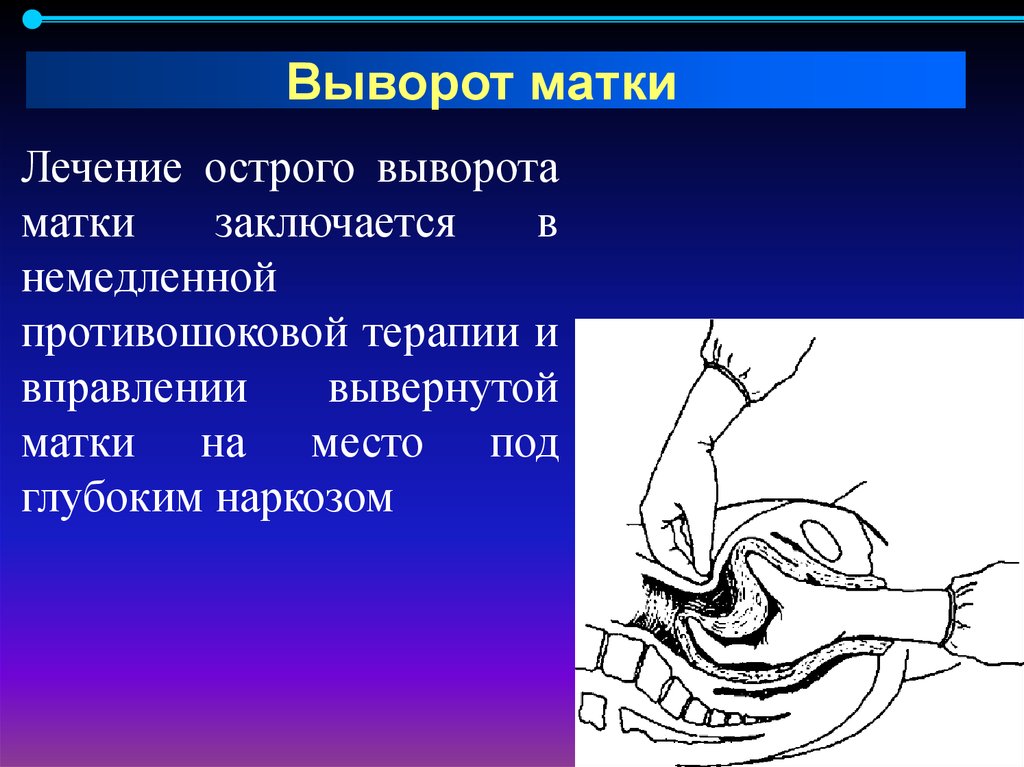 Материнский травматизм презентация