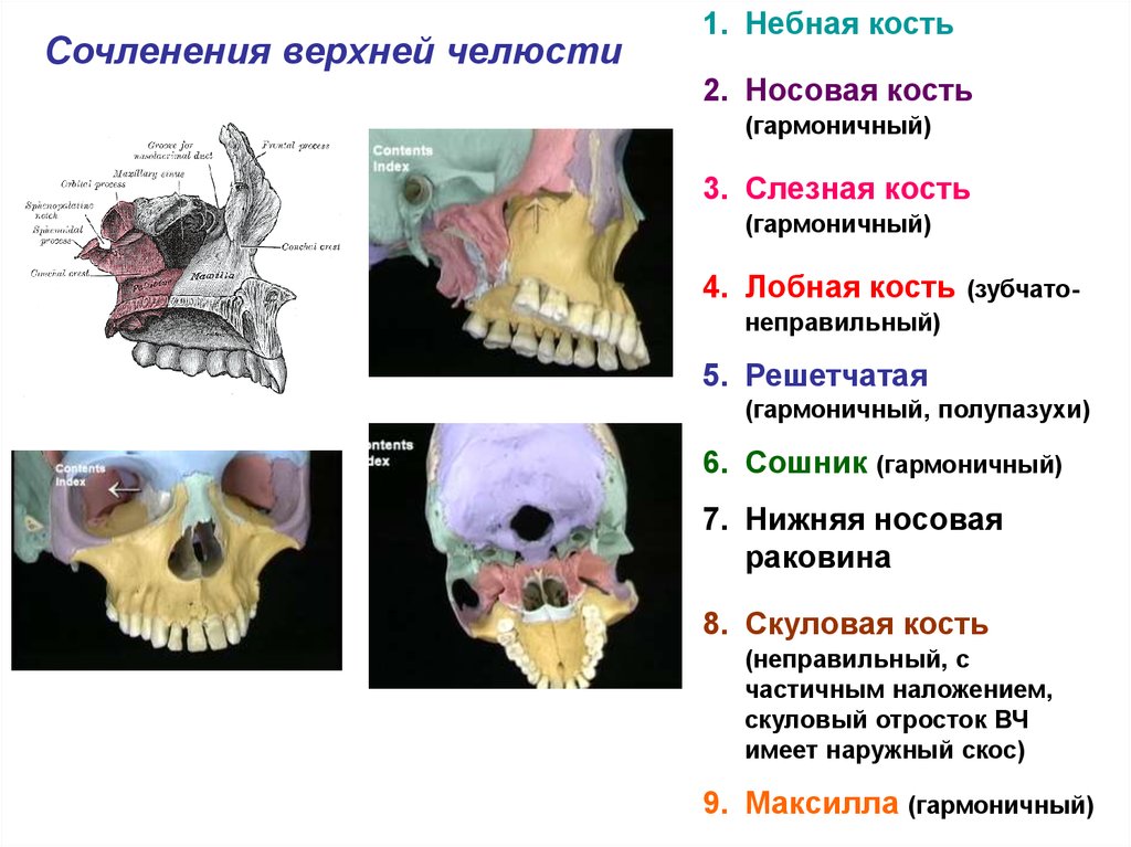 Кости лицевого черепа. Решетчатая кость и небная кость. Носовая кость слезная кость. Нёбная кость сошник нижняя носовая раковина. Верхнюю челюсть и решётчатую кость.