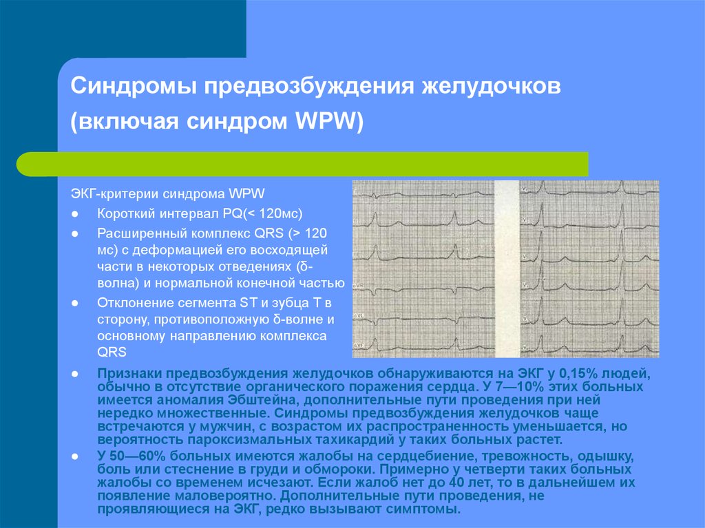 Экг синдромы. ЭКГ критерии синдрома wpw. Синдром преждевременного возбуждения желудочков на ЭКГ. Парциальный синдром предвозбуждения желудочков на ЭКГ. Критерии ВПВ синдрома на ЭКГ.