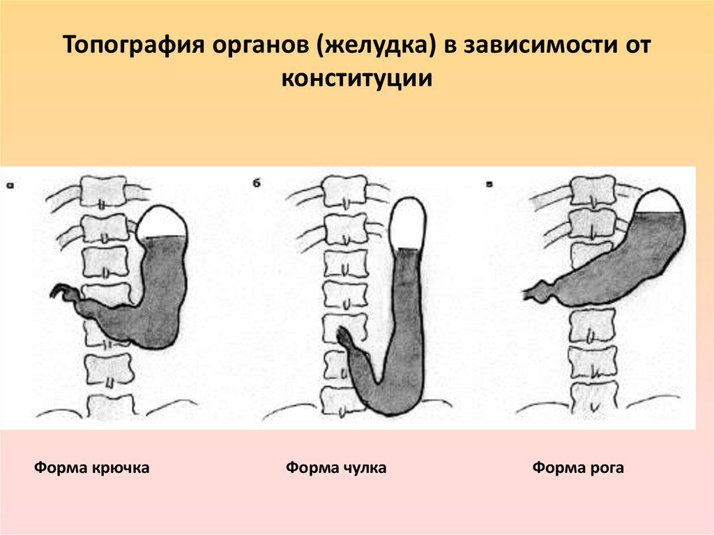 Виды желудка. Формы желудка в зависимости от телосложения. Форма желудка в зависимости от типа телосложения. Формы желудка при разных типах телосложения. Формы желудка анатомия.