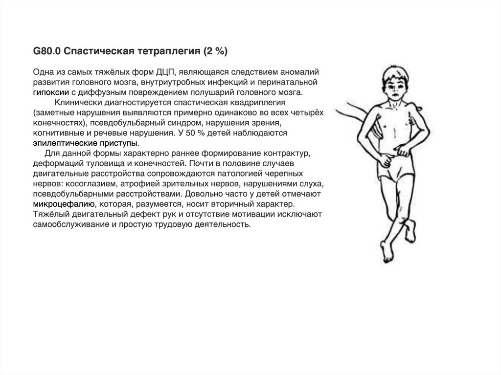 Детский церебральный паралич - презентация онлайн