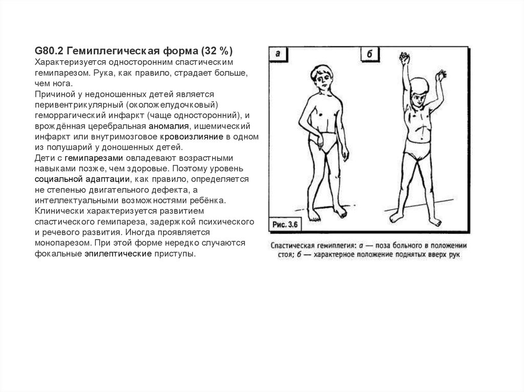 Детский церебральный паралич - презентация онлайн