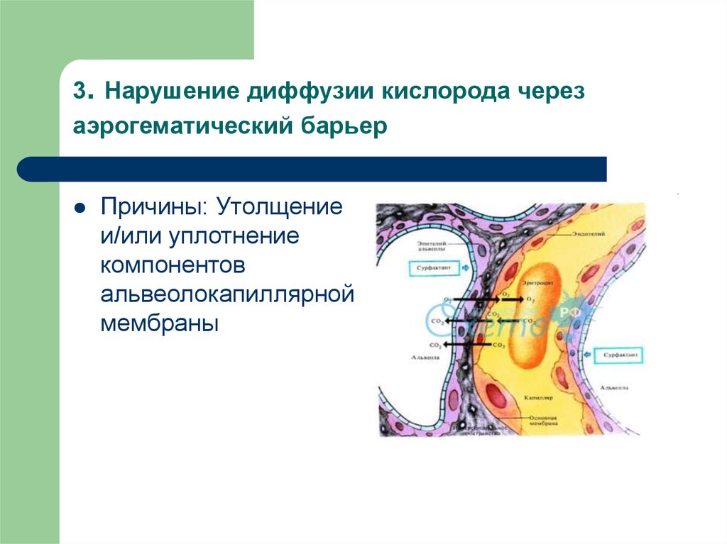 Аэрогематический барьер гистология рисунок