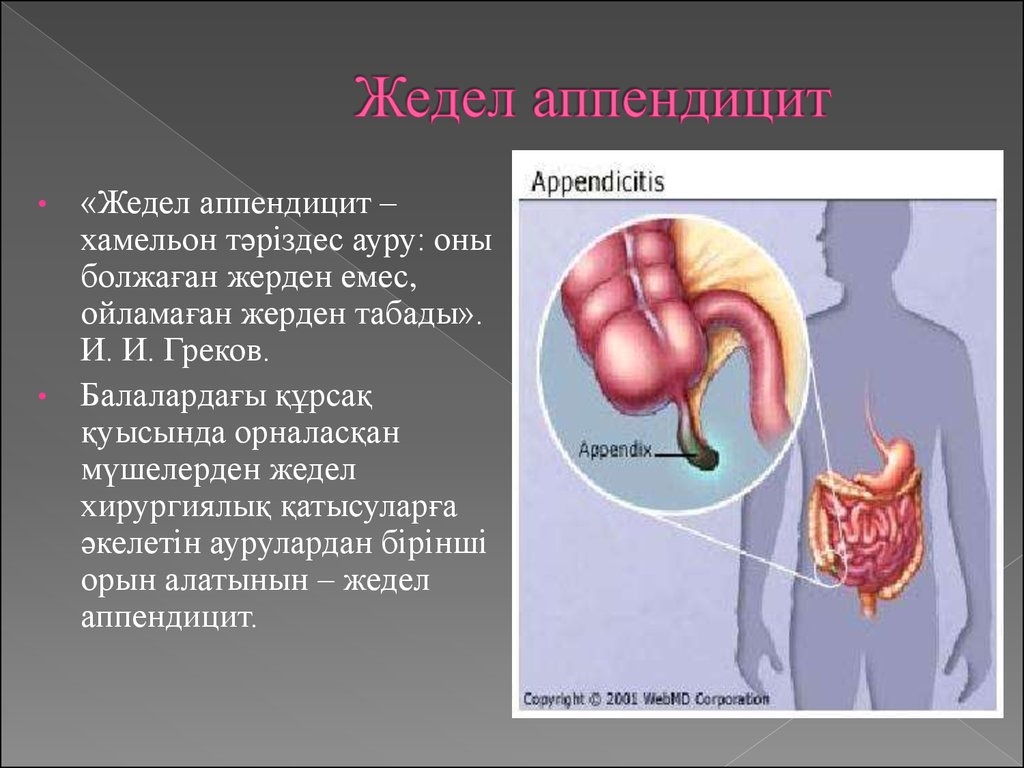 Аппендицит патанатомия
