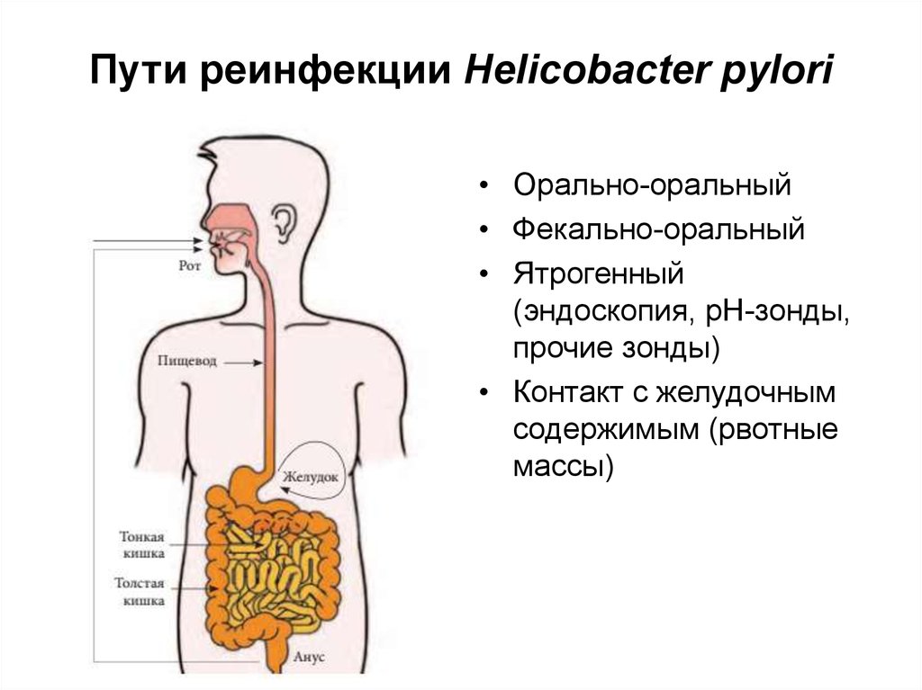 Причины появления хеликобактер в желудке
