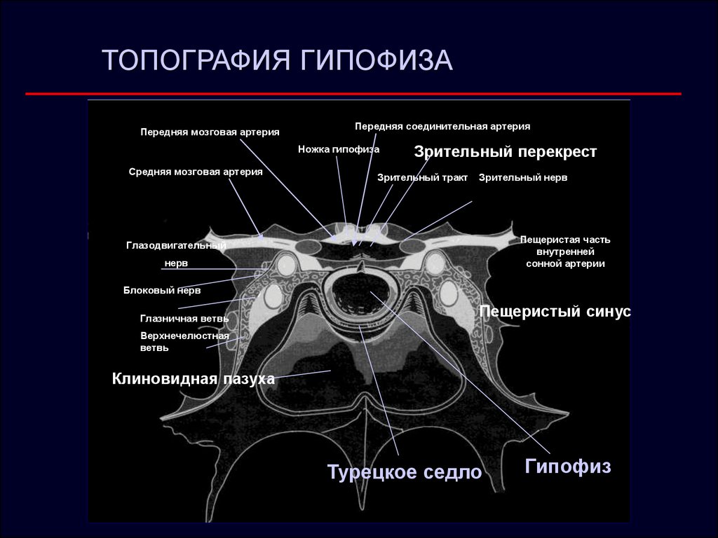 Артерии гипофиза. Кавернозный синус мрт анатомия. Пещеристый синус турецкое седло. Топография гипофиза.